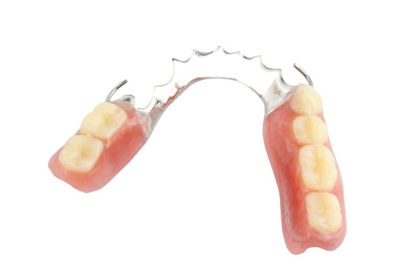 Mandibular Partial Denture