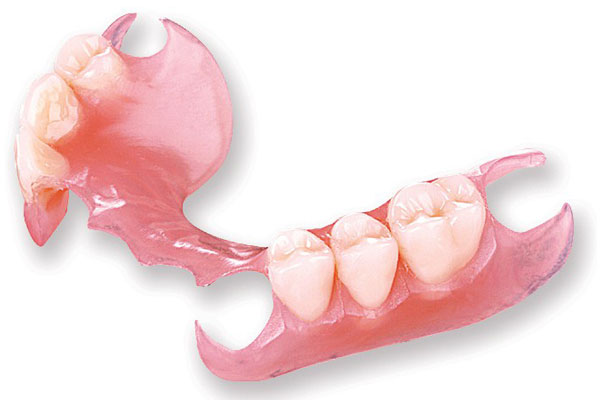 Maxillary Partial Denture